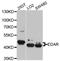 Ectodysplasin A Receptor antibody, A02639, Boster Biological Technology, Western Blot image 