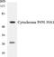 Cytochrome P450 Family 39 Subfamily A Member 1 antibody, LS-B14663, Lifespan Biosciences, Western Blot image 
