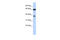 Protein RCC2 antibody, 27-106, ProSci, Enzyme Linked Immunosorbent Assay image 
