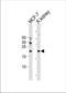 Adenine Phosphoribosyltransferase antibody, TA324754, Origene, Western Blot image 