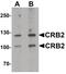 Crumbs homolog 2 antibody, PA5-34492, Invitrogen Antibodies, Western Blot image 