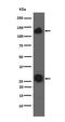 Integrin Subunit Alpha V antibody, M01561-1, Boster Biological Technology, Western Blot image 