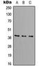 DNA Fragmentation Factor Subunit Beta antibody, orb256494, Biorbyt, Western Blot image 