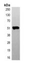 Tubulin Beta 3 Class III antibody, orb393345, Biorbyt, Immunoprecipitation image 