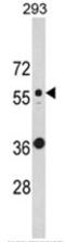 Keratin 10 antibody, AP17526PU-N, Origene, Western Blot image 