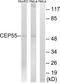 Centrosomal Protein 55 antibody, TA315571, Origene, Western Blot image 