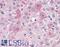 Dual Specificity Phosphatase 26 antibody, LS-A6785, Lifespan Biosciences, Immunohistochemistry paraffin image 