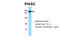 Protein Inhibitor Of Activated STAT 2 antibody, 28-341, ProSci, Western Blot image 