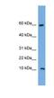 Chromosome 20 Open Reading Frame 144 antibody, NBP1-70460, Novus Biologicals, Western Blot image 
