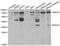 NK2 Homeobox 5 antibody, TA332816, Origene, Western Blot image 