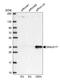 DnaJ Heat Shock Protein Family (Hsp40) Member C17 antibody, HPA040914, Atlas Antibodies, Western Blot image 