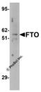 FTO Alpha-Ketoglutarate Dependent Dioxygenase antibody, 5137, ProSci, Western Blot image 