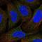 Discoidin, CUB and LCCL domain-containing protein 1 antibody, NBP2-32487, Novus Biologicals, Immunocytochemistry image 