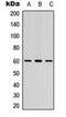 LYN Proto-Oncogene, Src Family Tyrosine Kinase antibody, orb315590, Biorbyt, Western Blot image 