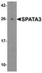 Spermatogenesis Associated 3 antibody, PA5-72723, Invitrogen Antibodies, Western Blot image 