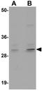 Centromere protein O antibody, GTX17045, GeneTex, Western Blot image 