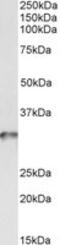 Tropomyosin 4 antibody, MBS423237, MyBioSource, Western Blot image 