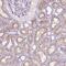 Stromelysin-3 antibody, HPA068864, Atlas Antibodies, Immunohistochemistry paraffin image 