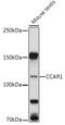 CARP1 antibody, GTX33069, GeneTex, Western Blot image 