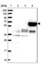 Methyltransferase Like 25 antibody, NBP1-82105, Novus Biologicals, Western Blot image 