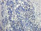 HLA class I histocompatibility antigen, A-1 alpha chain antibody, orb340829, Biorbyt, Immunohistochemistry paraffin image 