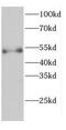 Caspase Recruitment Domain Family Member 9 antibody, FNab01272, FineTest, Western Blot image 