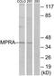 Progestin And AdipoQ Receptor Family Member 7 antibody, TA316189, Origene, Western Blot image 