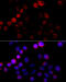 Enoyl-CoA Hydratase 1 antibody, 14-714, ProSci, Immunohistochemistry paraffin image 