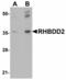 Rhomboid domain-containing protein 2 antibody, LS-C108640, Lifespan Biosciences, Western Blot image 