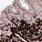 Zinc Finger Protein 665 antibody, HPA023437, Atlas Antibodies, Immunohistochemistry paraffin image 