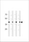 Cdk5 And Abl Enzyme Substrate 2 antibody, 60-986, ProSci, Western Blot image 