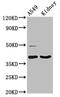 Galectin 12 antibody, CSB-PA846606LA01HU, Cusabio, Western Blot image 