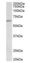 Hypermethylated in cancer 2 protein antibody, orb43515, Biorbyt, Western Blot image 