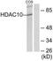 Histone deacetylase 10 antibody, TA316505, Origene, Western Blot image 
