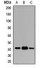 ST13 Hsp70 Interacting Protein antibody, orb412738, Biorbyt, Western Blot image 