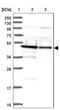 DNA Damage Inducible 1 Homolog 2 antibody, NBP2-47493, Novus Biologicals, Western Blot image 