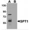 SPTLC1 antibody, MBS150884, MyBioSource, Western Blot image 
