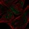 MYCL Proto-Oncogene, BHLH Transcription Factor antibody, HPA063132, Atlas Antibodies, Immunocytochemistry image 