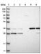 Aminolevulinate Dehydratase antibody, PA5-54564, Invitrogen Antibodies, Western Blot image 