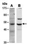 BCL6B Transcription Repressor antibody, orb67052, Biorbyt, Western Blot image 