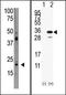 PDGFA Associated Protein 1 antibody, AP13232PU-N, Origene, Western Blot image 