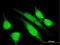 E3 ubiquitin-protein ligase MGRN1 antibody, H00023295-M07, Novus Biologicals, Immunocytochemistry image 