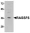 Ras Association Domain Family Member 6 antibody, orb75679, Biorbyt, Western Blot image 