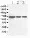 Cell Division Cycle 25B antibody, PA1546, Boster Biological Technology, Western Blot image 