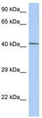 Nuclear Receptor Subfamily 5 Group A Member 1 antibody, TA338171, Origene, Western Blot image 