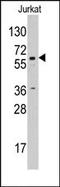 Cytochrome P450 Family 19 Subfamily A Member 1 antibody, AP14221PU-N, Origene, Western Blot image 
