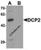 Decapping MRNA 2 antibody, 7049, ProSci, Western Blot image 