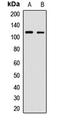 OB-cadherin antibody, LS-C667719, Lifespan Biosciences, Western Blot image 