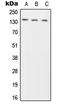 PTP-NP antibody, LS-C352743, Lifespan Biosciences, Western Blot image 