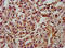 N(Alpha)-Acetyltransferase 60, NatF Catalytic Subunit antibody, LS-C674133, Lifespan Biosciences, Immunohistochemistry paraffin image 